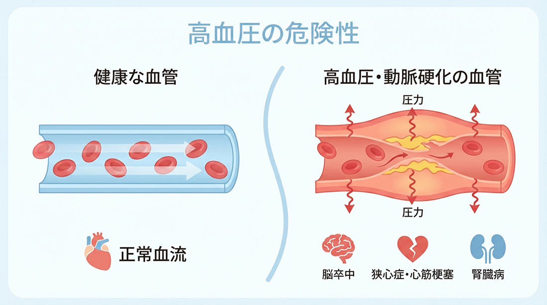高血圧の危険性