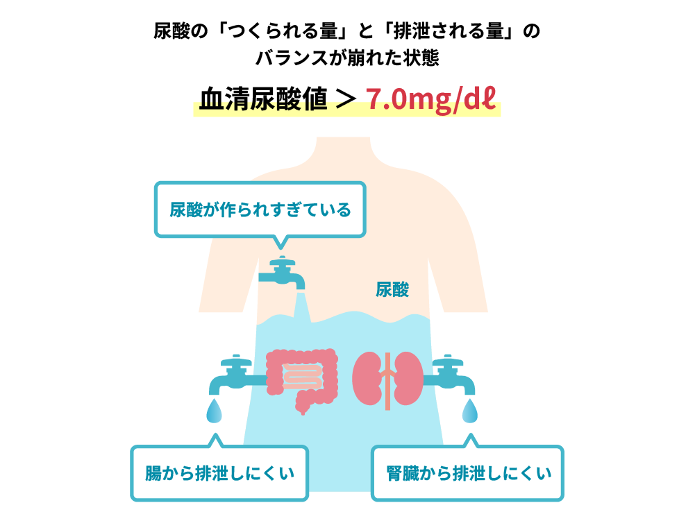 高尿酸血症とは